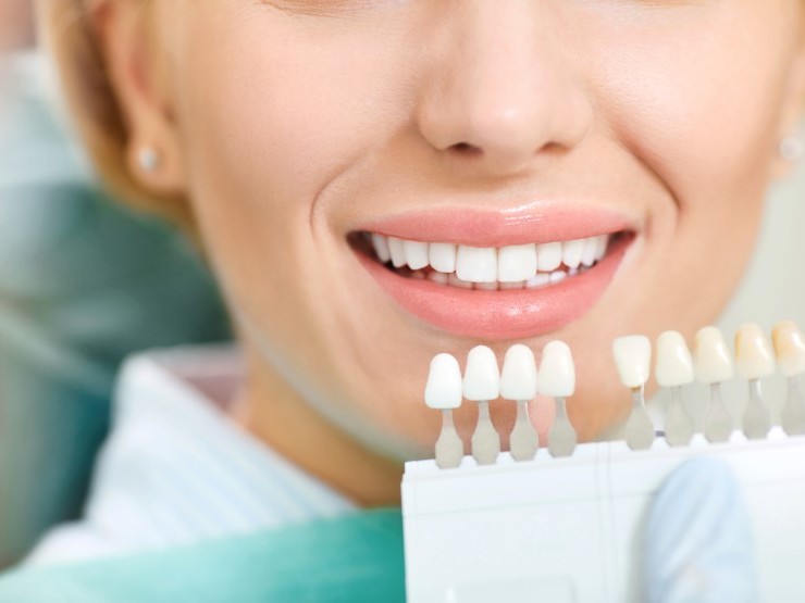 Teeth Whitening: Simple, Safe and Effective 